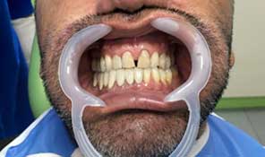Estetica Dental